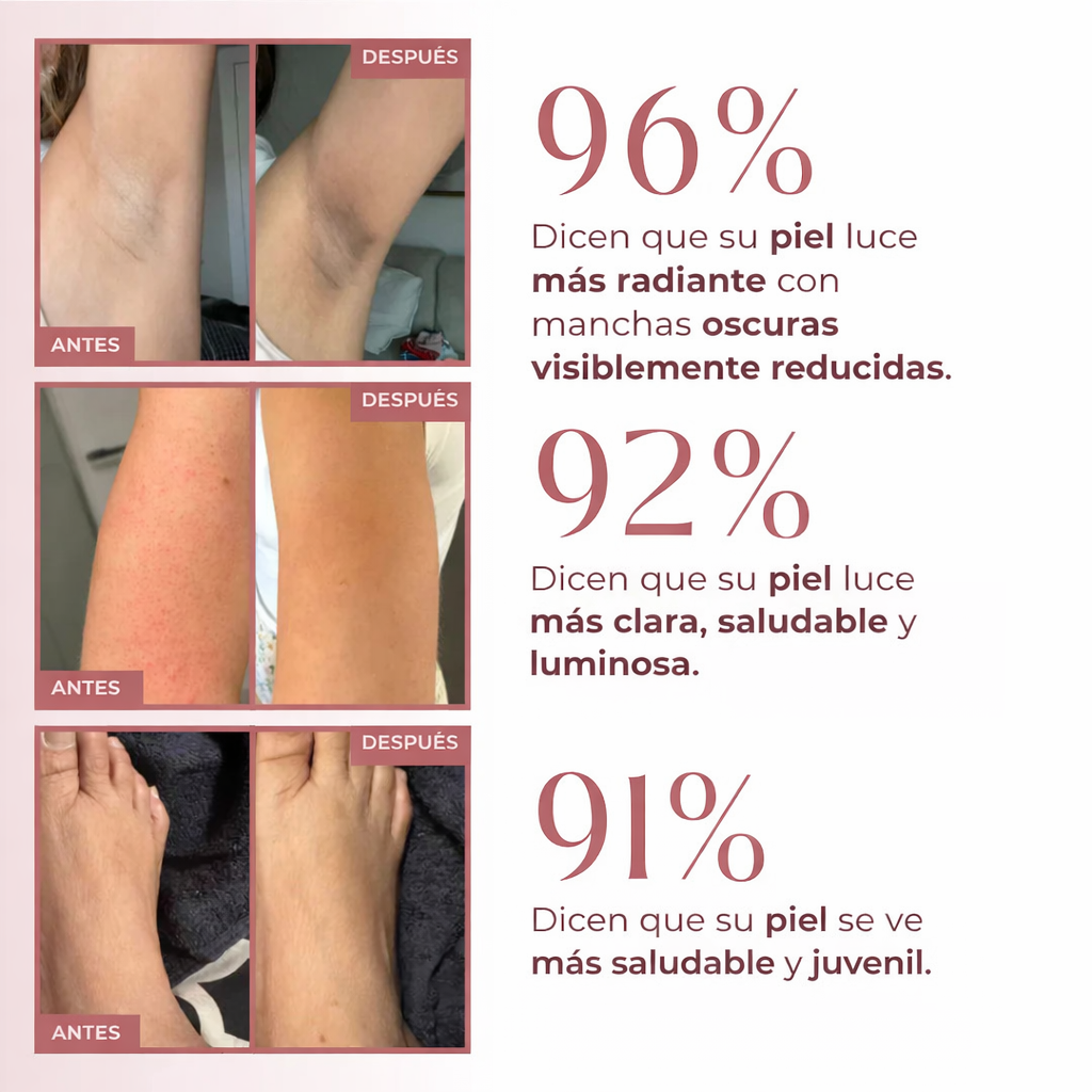 Spray exfoliante corporal - Ácido kójico + cúrcuma