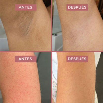 Spray exfoliante corporal - Ácido kójico + cúrcuma